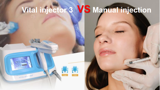 As vantagens do injetor vital em comparação com a injeção manual