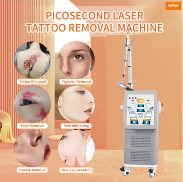 Laser Picosencond --- Como remover tatuagens com eficácia?