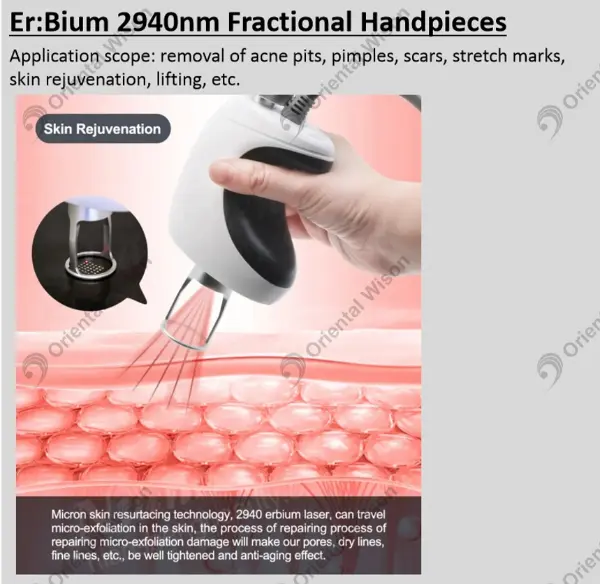 Novo especialista em renovação de pele - laser de érbio 2940nm